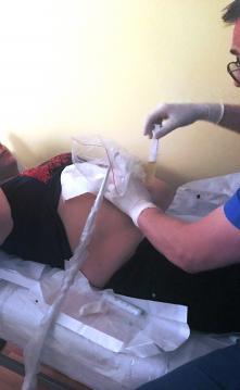 amniocentesis